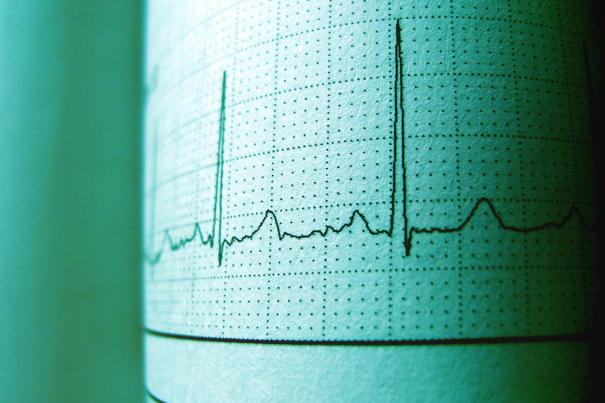 Drug trial targets stubborn cholesterol - feature photo